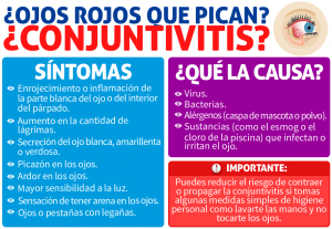 Conjuntivitis1