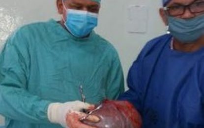 Extirpan quiste gigante de ovario de 9 libras a paciente en hospital de El Seibo